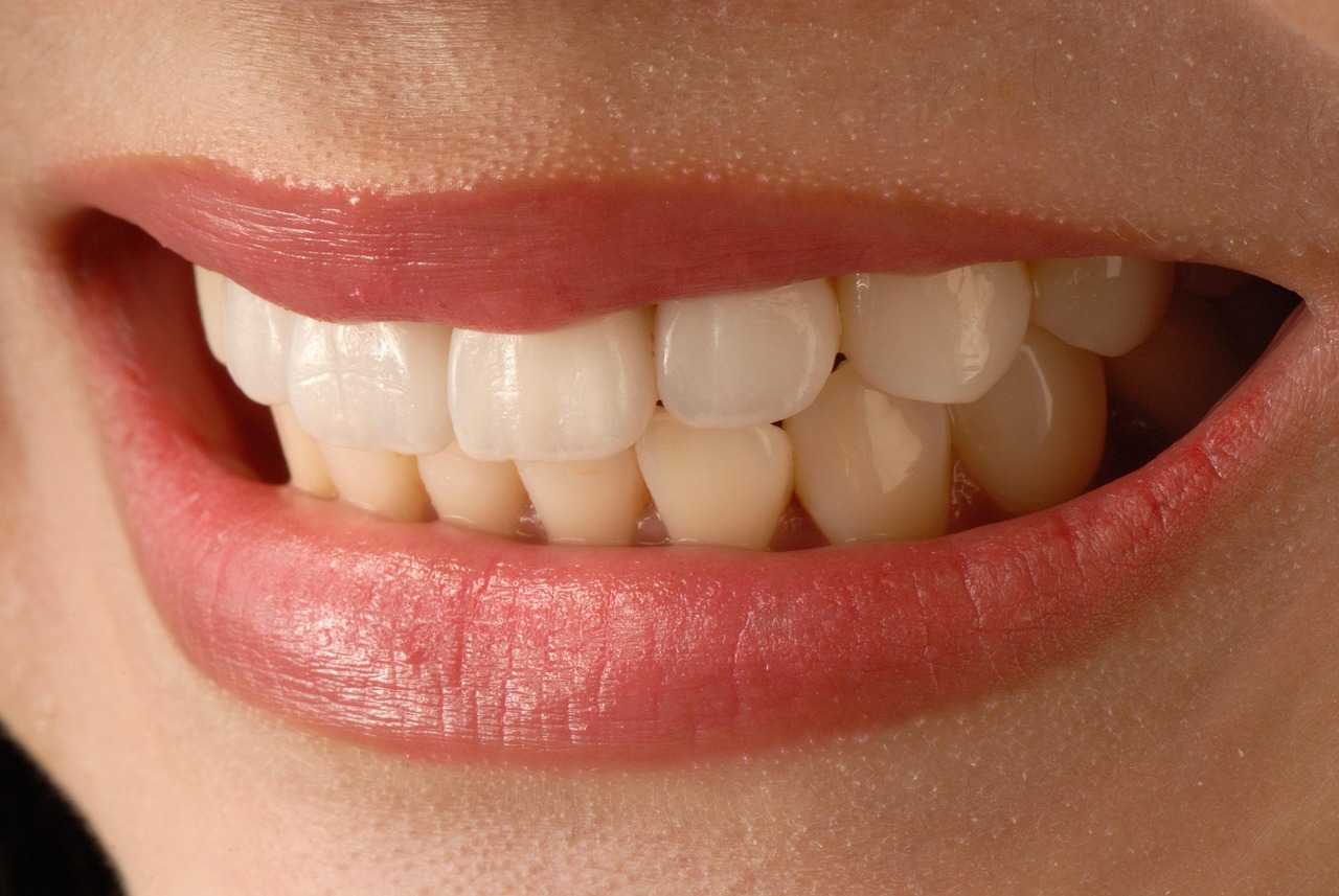 Houston Veneers: Are They Right For Your Smile Makeover?